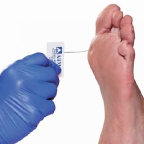 Diabetische voet